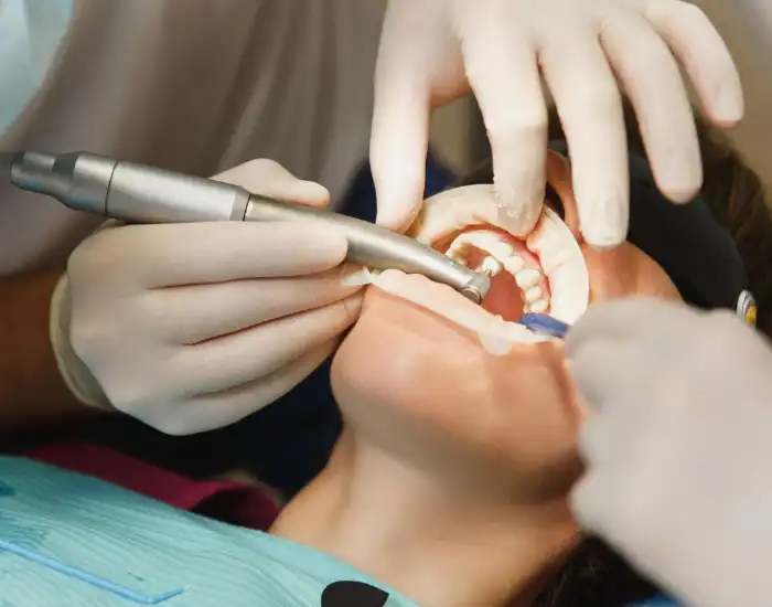 Why Do I Need a Dental Crown?