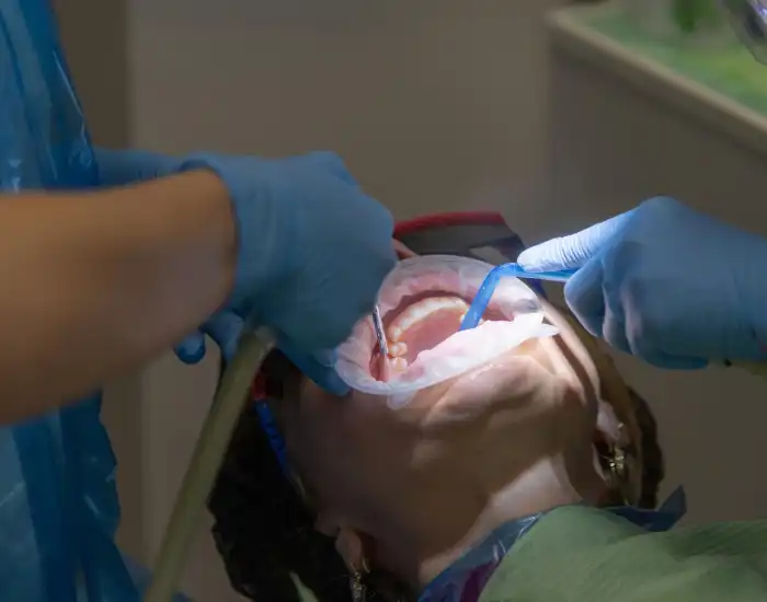 How Emergency Dentist Can Replace a Lost Tooth