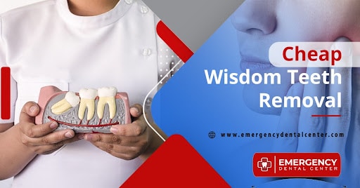 Cheap Wisdom Teeth Removal 