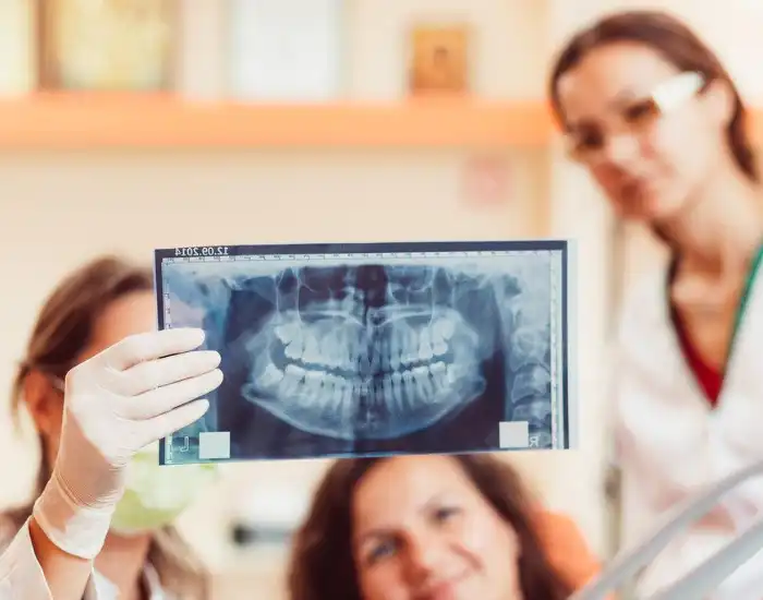 Wisdom Teeth Removal: Why Might You Need It?