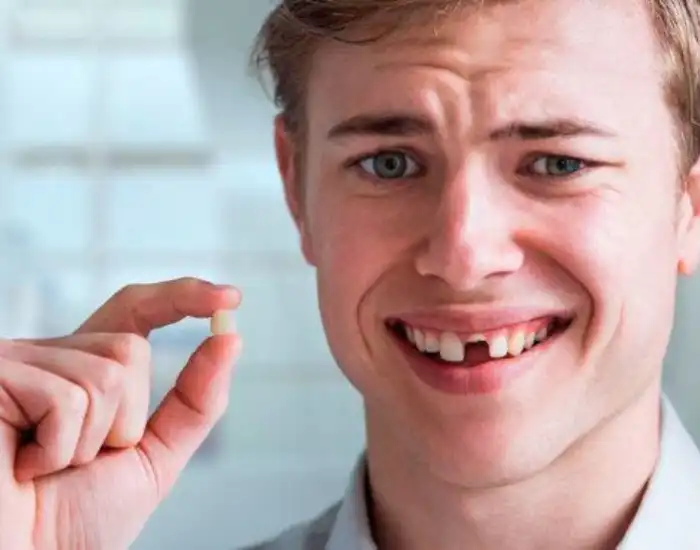 What should i do if my tooth has been knocked-out?
