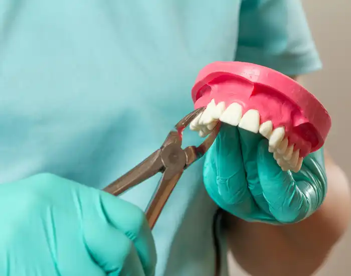 Understanding Tooth Extractions: Why, When, and How